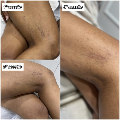 Home created by photogrid